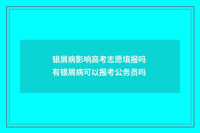银屑病影响高考志愿填报吗 有银屑病可以报考公务员吗